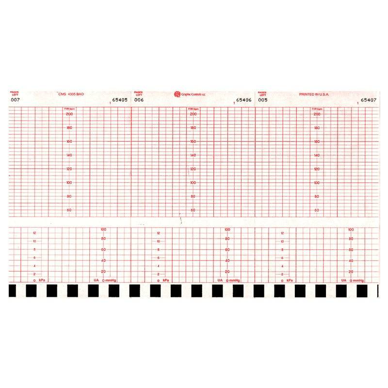 Fetal Chart Paper for Labour and Delivery
