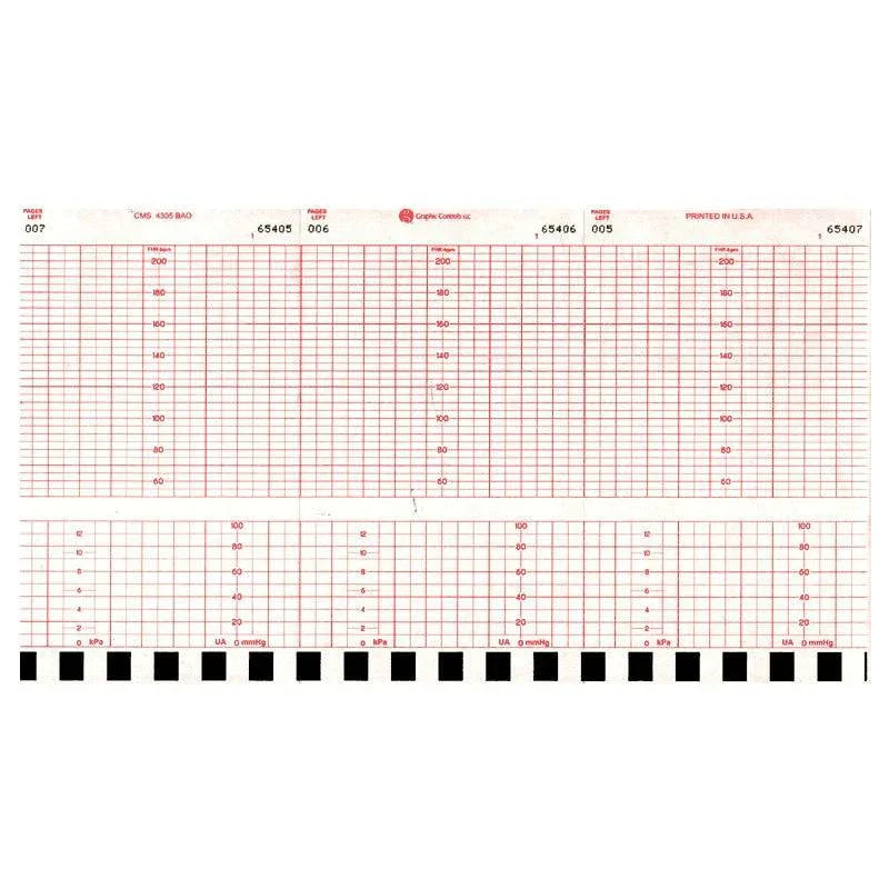 Fetal Chart Paper for Labour and Delivery