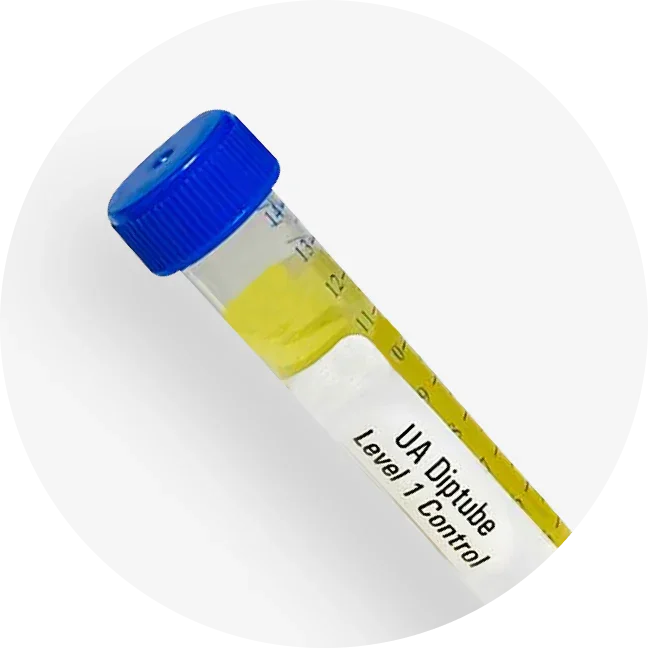 Urinalysis Controls