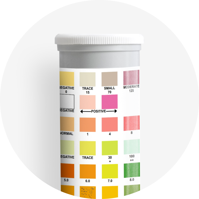 Urine Analysis Testing