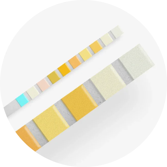 Urine Reagent Strips