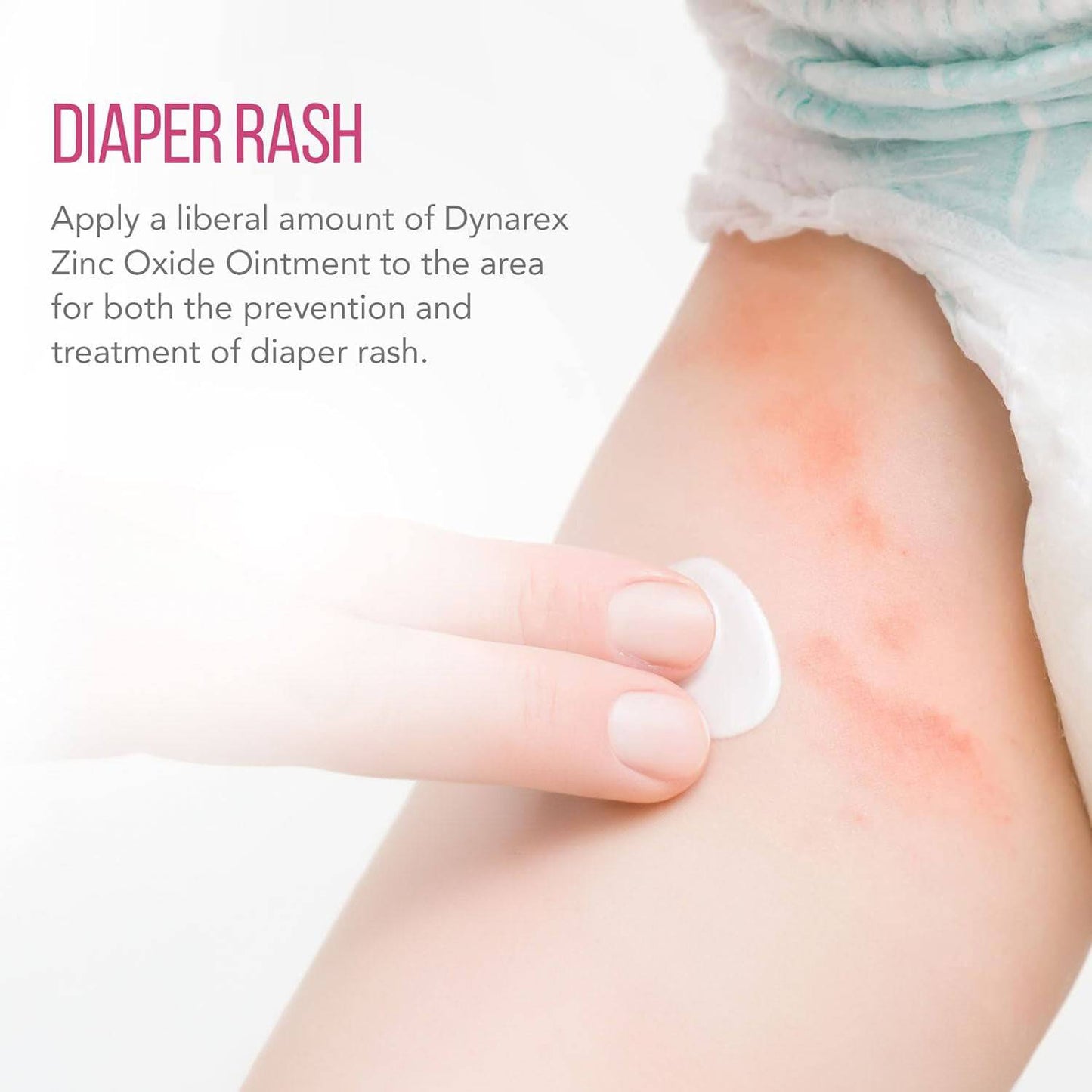 Zinc Oxide Ointments