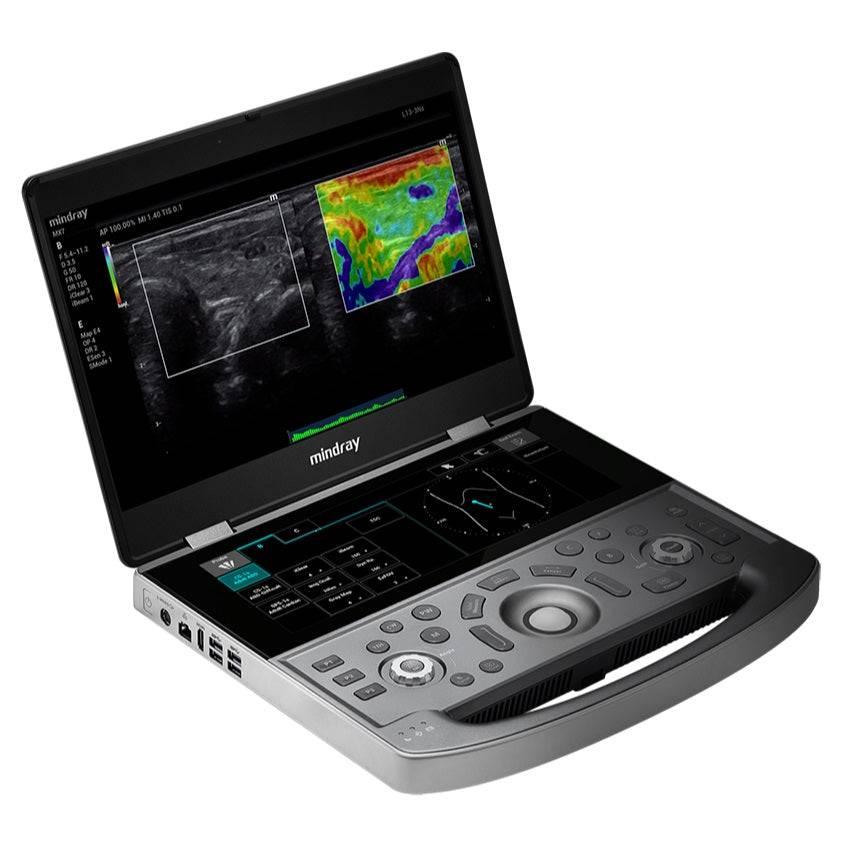 Mindray MX7 Portable Ultrasound System