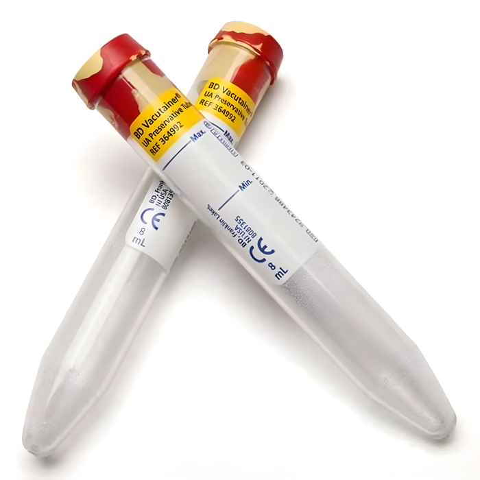 BD Vacutainer Urine Collection Tube - 8.0 mL with Red/Yellow Cap and Additives