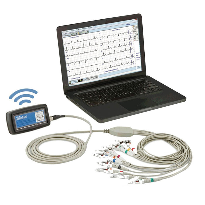 Cutting-Edge PC-Based ECG System