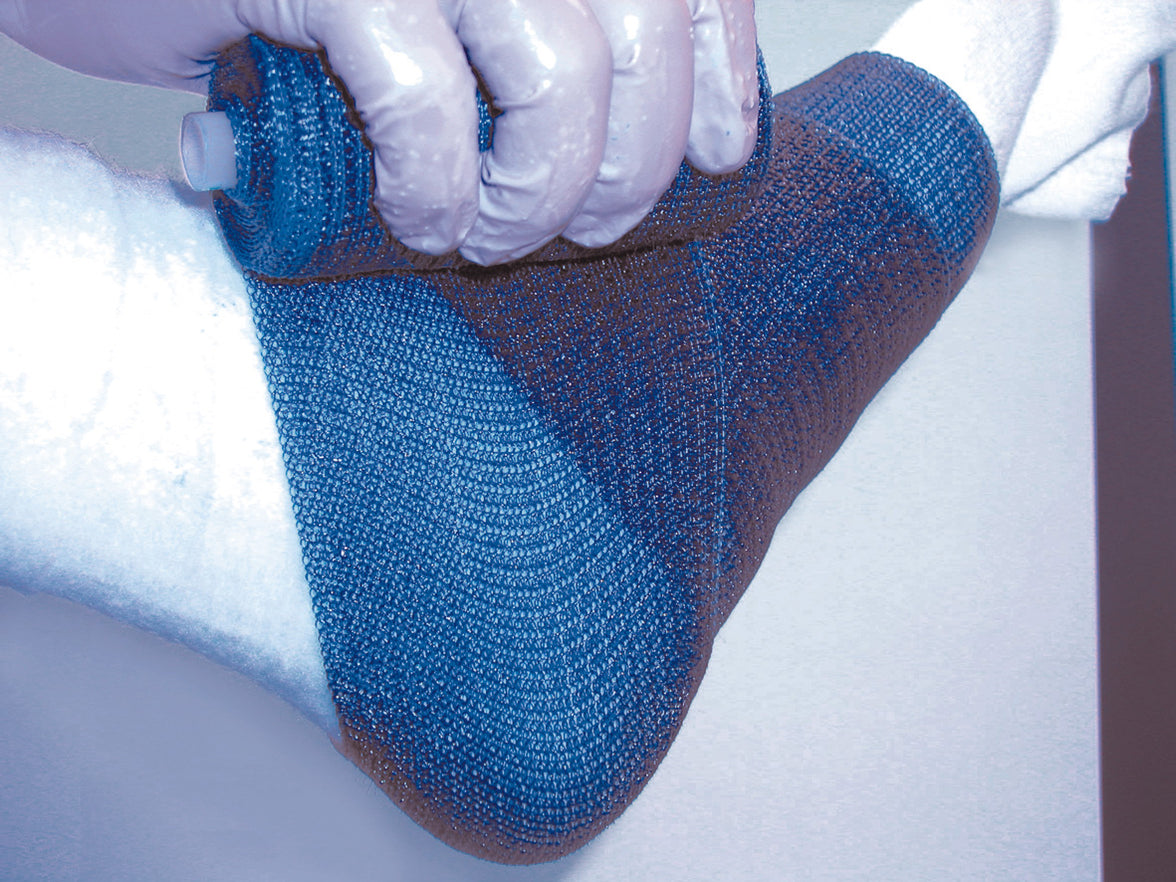 Fibercasting Delta-Lite Plus Fiberglass Caste Tape — MedicalRite