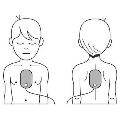 Philips HeartStart FRx AED Defibrillator