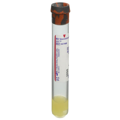 Vacutainer Blood Collection Tube - SST