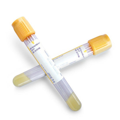 Vacutainer Blood Collection Tube - SST