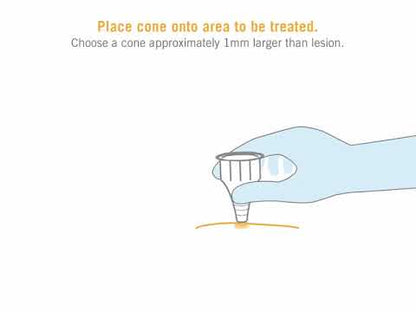 Cryodose Dosing Cones Treatment Kit