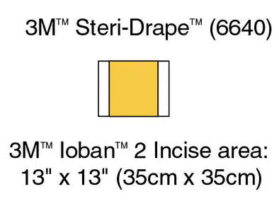 Incise Drape Sterile